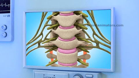 3D Medical Video